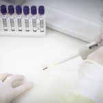 Paciente com indícios de Ebola é admitido em hospital de São Paulo