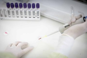 Paciente com indícios de Ebola é admitido em hospital de São Paulo