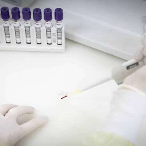 Paciente com indícios de Ebola é admitido em hospital de São Paulo