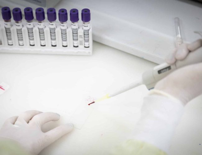 Paciente com indícios de Ebola é admitido em hospital de São Paulo